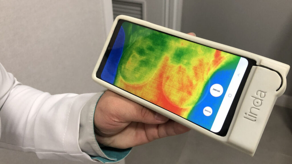 Grupo PróVida usa IA para detecção precoce do câncer de mama